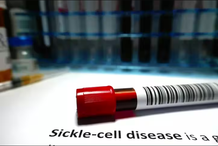 Over 20 lakh from tribal areas screened for sickle cell anaemia in past 8 years: ..